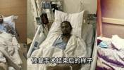 KD最奇！科比、杜兰特、塔图姆跟腱断裂修复手术结束后的样子